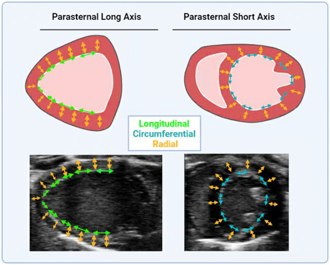Speckle tracking echocardiography: A new approach to myocardial function