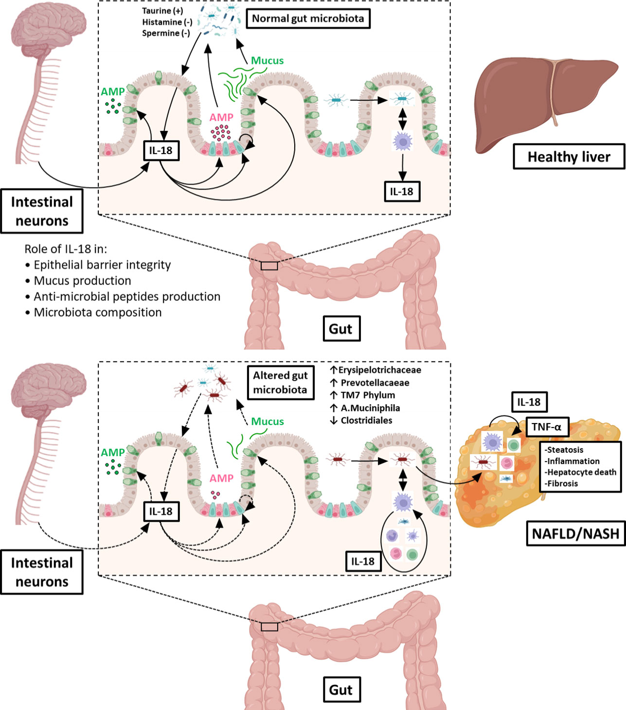 Frontiers | Interleukin-18 in metabolism: From mice physiology to human ...