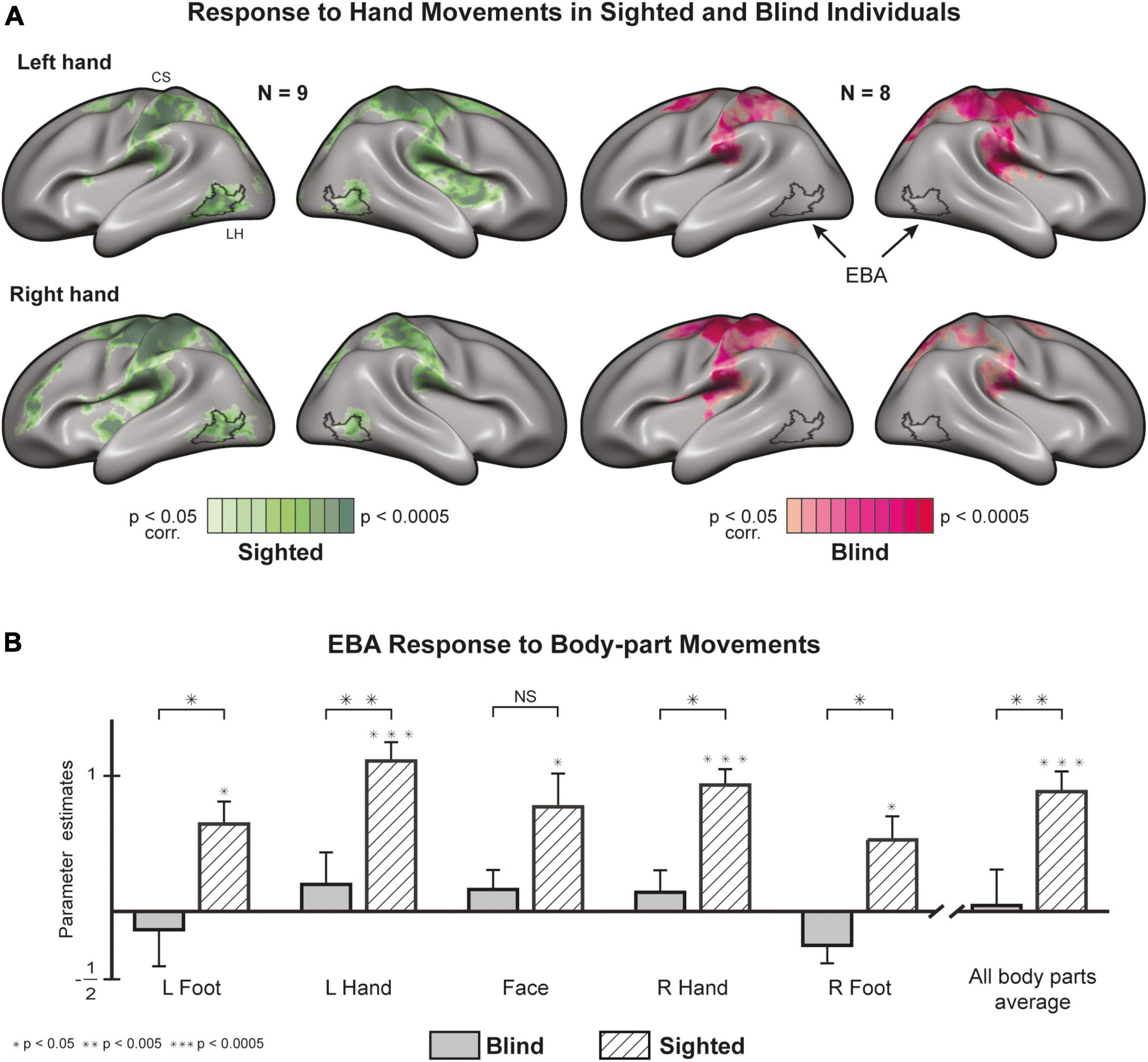 Frontiers  The brain-body disconnect: A somatic sensory basis for