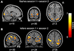 Frontiers | Heterogeneity of stimulus-specific response modification—an ...