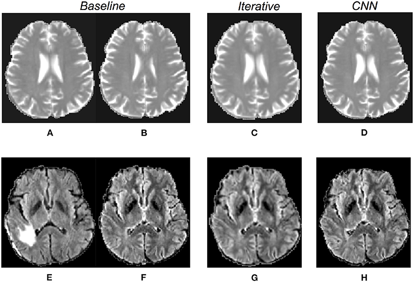 Frontiers | Quantitative evaluation of the influence of multiple MRI ...