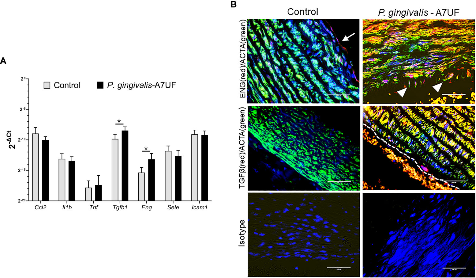 Anal Thrombosis - Frontiers | Differential affinity chromatography reveals a link between  Porphyromonas gingivalisâ€“induced changes in vascular smooth muscle cell  differentiation and the type 9 secretion system