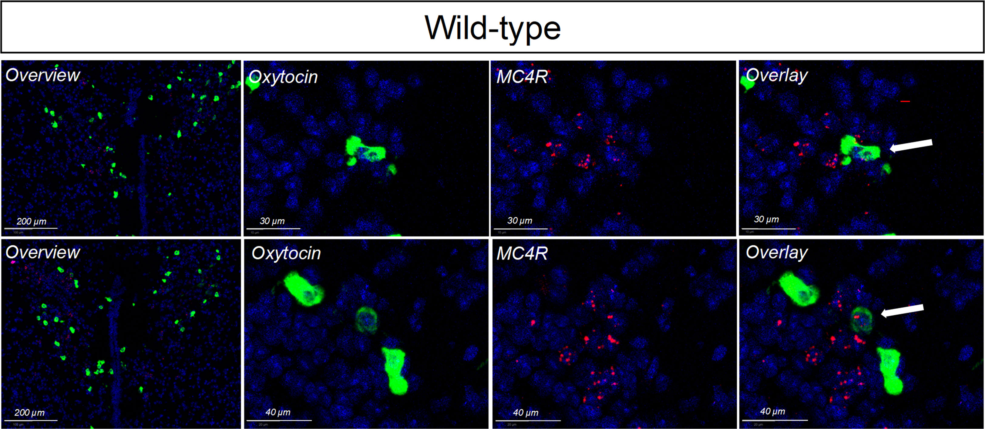 Transgenic Mice Expressing Green Fluorescent Protein under the Control of  the Melanocortin-4 Receptor Promoter