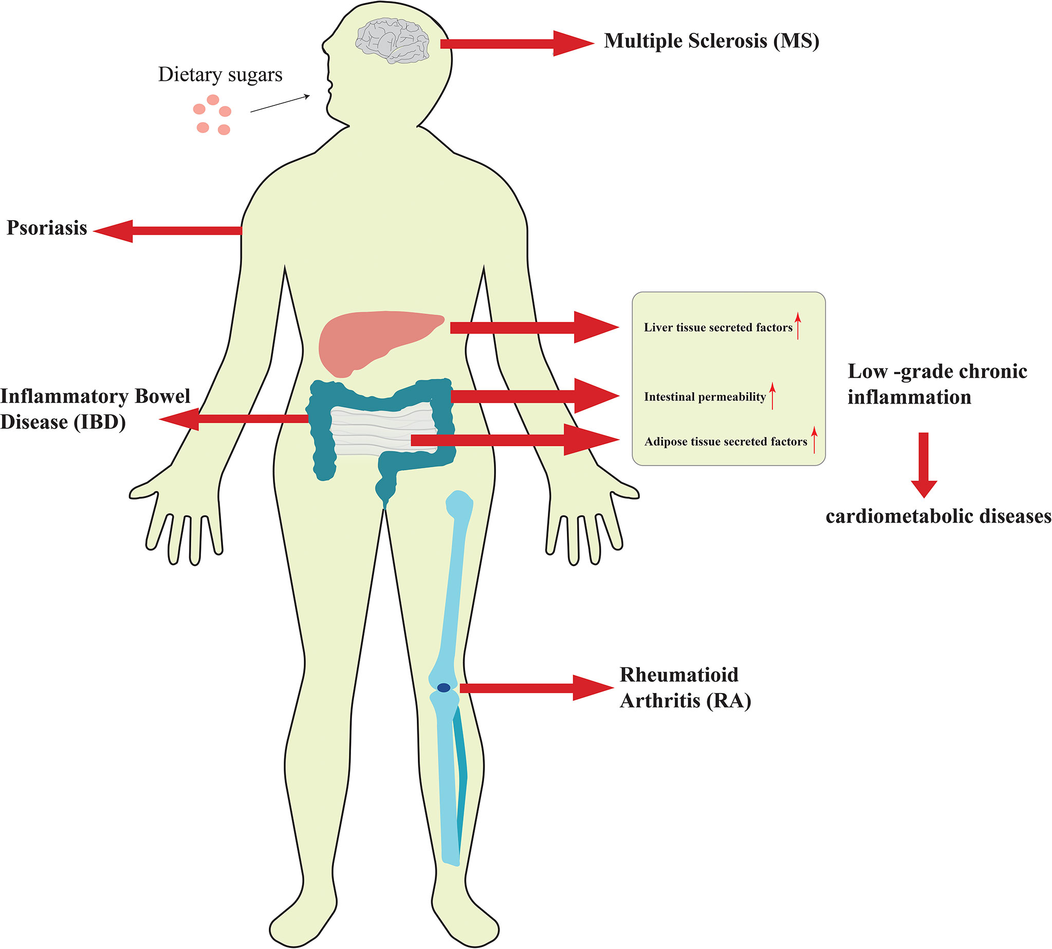 Frontiers Excessive Intake Of Sugar An Accomplice Of Inflammation