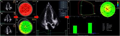 Reference values for two-dimensional myocardial strain echocardiography of  the left ventricle in healthy children, Cardiology in the Young