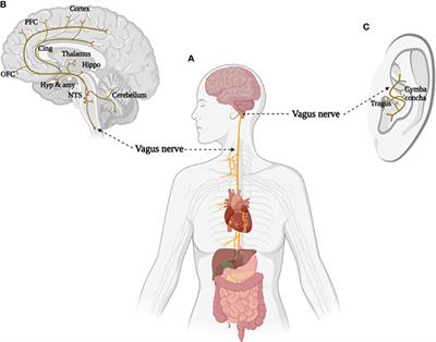 Transcutaneous auricular vagus nerve stimulation as a potential novel  treatment for polycystic ovary syndrome