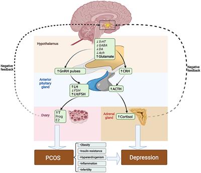 Frontiers | Depression in polycystic ovary syndrome: Focusing on ...