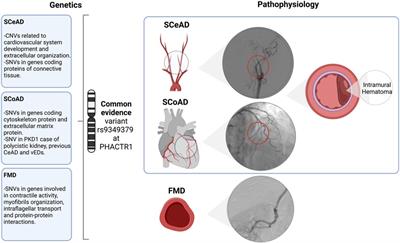 Frontiers  Genetics of spontaneous cervical and coronary artery dissections