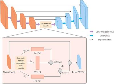 Frontiers | ESA-UNet for assisted diagnosis of cardiac magnetic ...