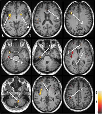 brain test Archives - Page 8 of 28 