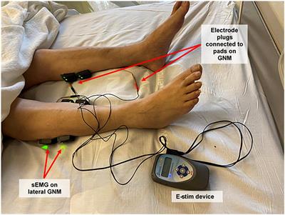 Neuromuscular electrical stimulation (EMS) of the quadriceps muscles