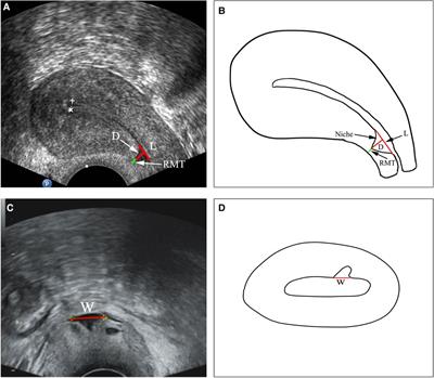 Frontiers | Comparative effectiveness of transvaginal repair vs ...