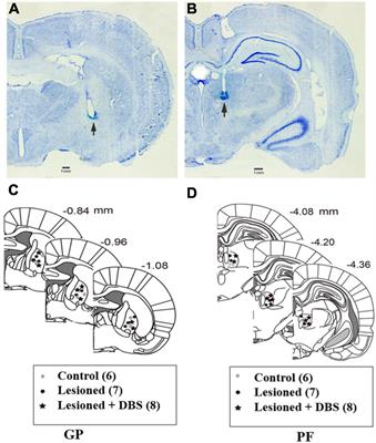 Frontiers | Deep brain stimulation in the globus pallidus alleviates ...