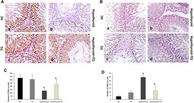 Frontiers | Thymoquinone protects the testes of hypothyroid rats by ...