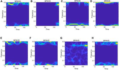 Frontiers | Multimodal attention-based deep learning for automatic  modulation classification