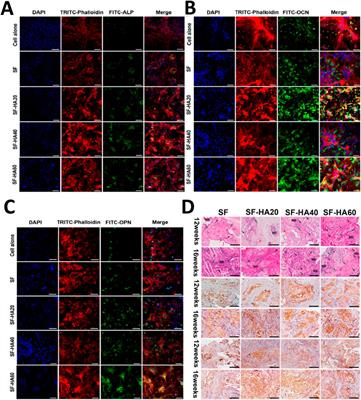 Frontiers | Silk fibroin scaffolds: A promising candidate for bone ...