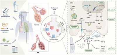 Senescent Aec And The Implication For Idiopathic Pulmonary Fibrosis Treatment Frontiers