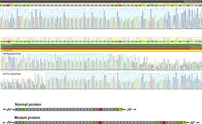 Figure 1. [Facial appearance of a girl age 11 years with FHS (SRCAP  pathogenic variant p.Arg2444Ter)]. - GeneReviews® - NCBI Bookshelf