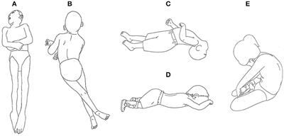 Cerebral Palsy Posture Gains – Functional Patterns