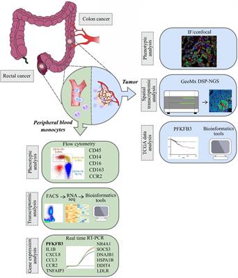 Frontiers  PFKFB3 overexpression in monocytes of patients with colon but  not rectal cancer programs pro-tumor macrophages and is indicative for  higher risk of tumor relapse