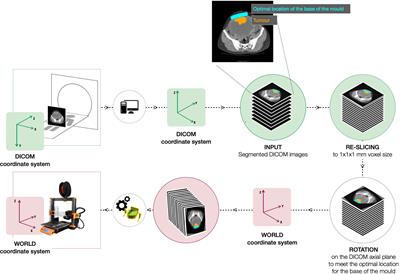 Frontiers | Lesion-specific 3D-printed moulds for image-guided tissue ...