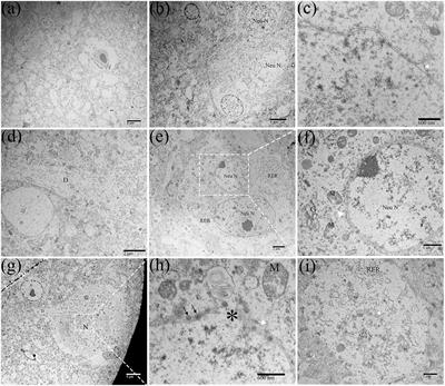 Frontiers | Ultrastructural study of the duck brain infected with duck ...