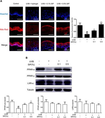 Frontiers | Protective effect of Saussurea involucrata polysaccharide ...