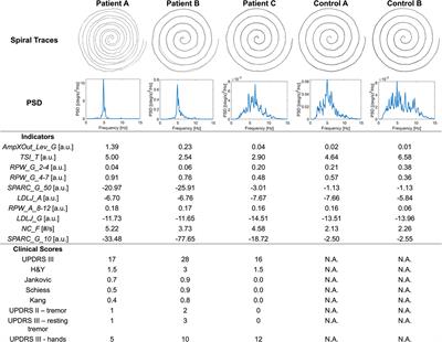 Frontiers | Spiral drawing analysis with a smart ink pen to identify ...