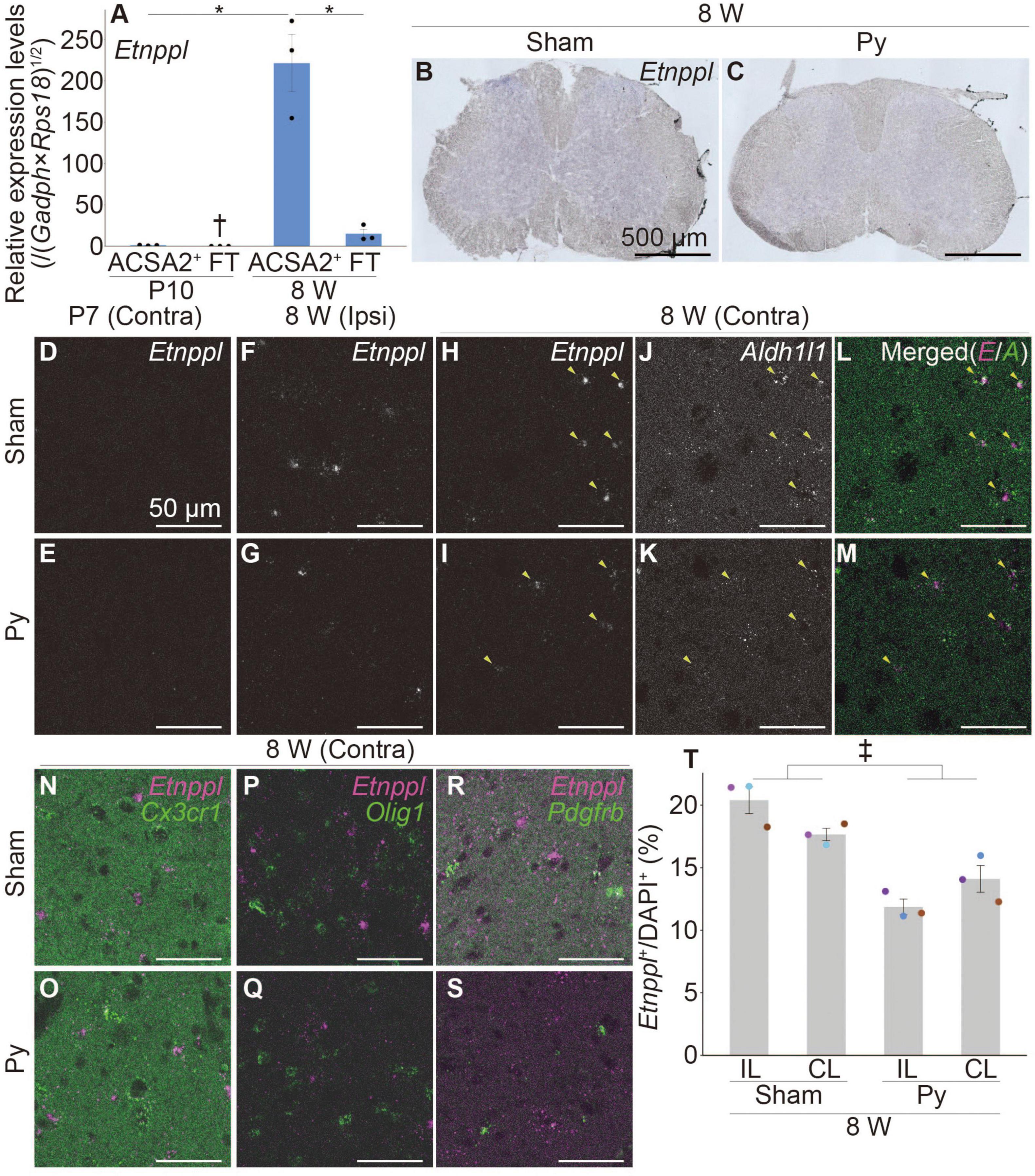 Frontiers  Utilization of ethanolamine phosphate phospholyase as a unique  astrocytic marker