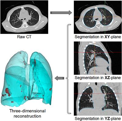 Leveraging Datature Nexus for Tumor and Anomaly Detection in Medical Scans  : Part I