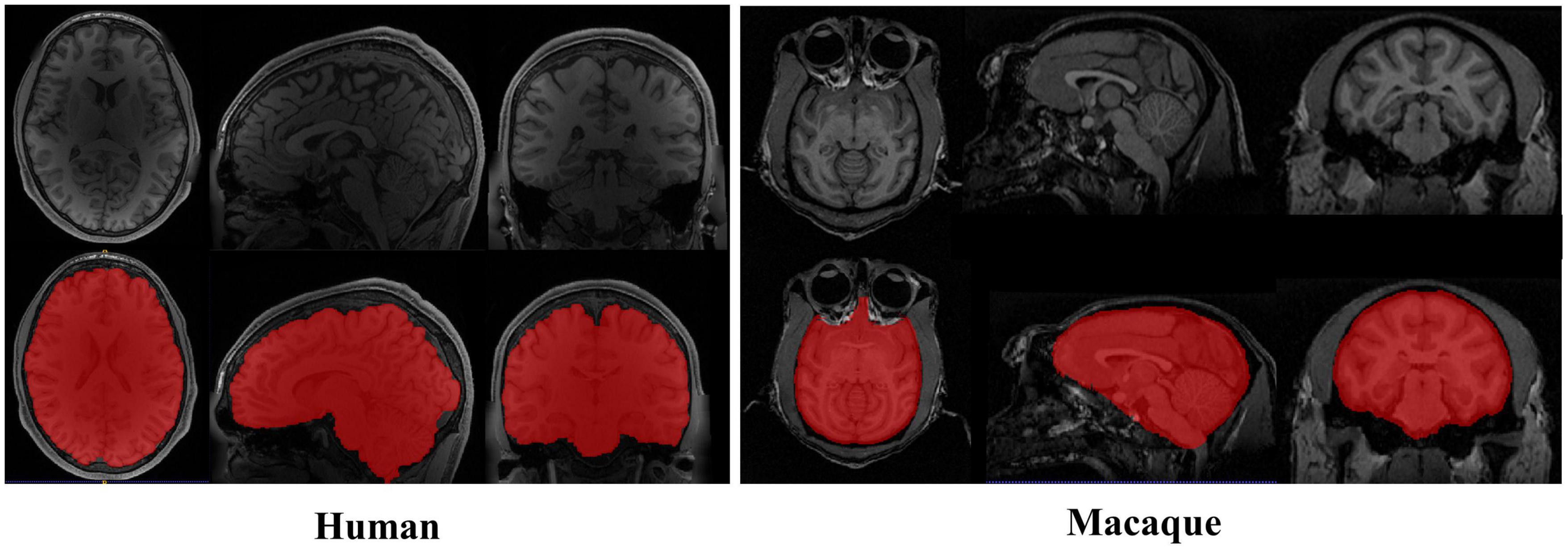 Smooth and edge-enhancement of a medical image. (a) Slice of an MRI