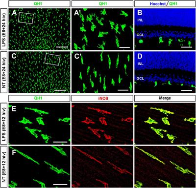 Frontiers | LPS-stimulated microglial cells promote ganglion cell death ...