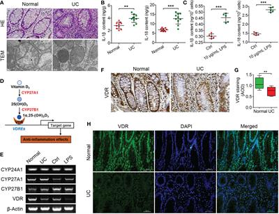 Frontiers | Vitamin D3 alleviates inflammation in ulcerative colitis by ...