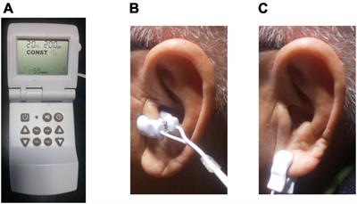 Frontiers | Afterload reduction after non-invasive vagus nerve ...