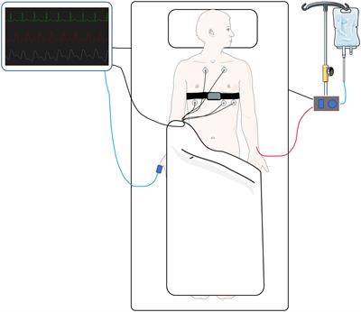 Frontiers  A Pilot Study of Blood Pressure Monitoring After Cardiac  Surgery Using a Wearable, Non-invasive Sensor