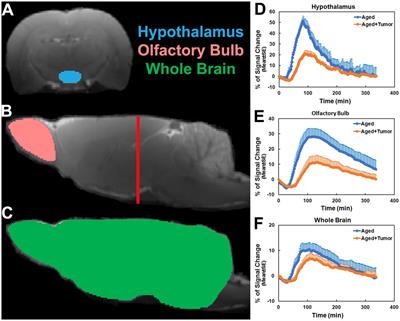 Glymphatic transport is reduced in rats with spontaneous pituitary tumor -  Frontiers