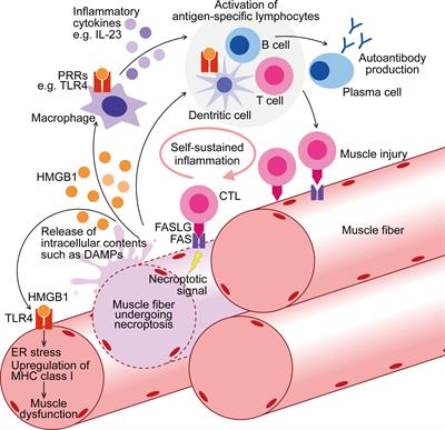 Frontiers | Muscle fiber necroptosis in pathophysiology of idiopathic ...