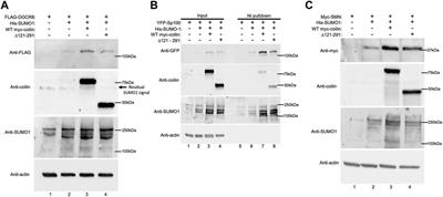 Frontiers | The Cajal body marker protein coilin is SUMOylated and ...