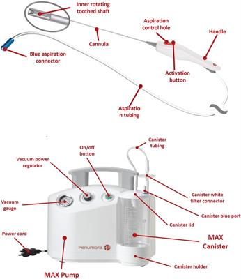 A novel implant removal technique by endoscopy, Journal of Orthopaedic  Surgery and Research