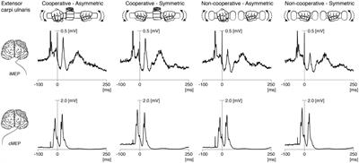 Frontiers | Modulation of ipsilateral motor evoked potentials during ...