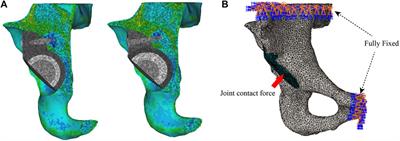 Frontiers  Well-Placed Acetabular Component Oriented Outside the Safe Zone  During Weight-Bearing Daily Activities