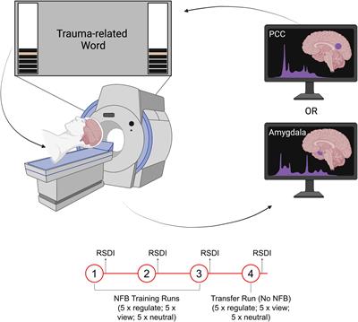 Frontiers  The brain-body disconnect: A somatic sensory basis for