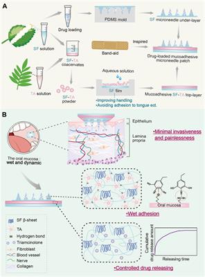 Oral Submucous Fibrosis: A Guide to Diagnosis and Management