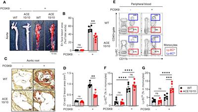 Accelerated atherosclerosis development in C57Bl6 mice by overexpressing  AAV-mediated PCSK9 and partial carotid ligation - Laboratory Investigation