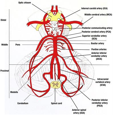 Frontiers | Incidence, clinical features, and outcomes of posterior ...