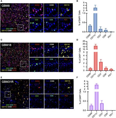 Frontiers | Establishment and immune phenotyping of patient-derived ...