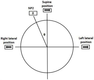 Frontiers | Clinical characteristics and lateralization of the ...