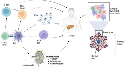 Frontiers | The role of dendritic cells in MASH: friends or foes?