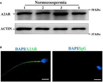 The adenosine A2A receptor in human sperm: its role in sperm motility and association with in vitro fertilization outcomes