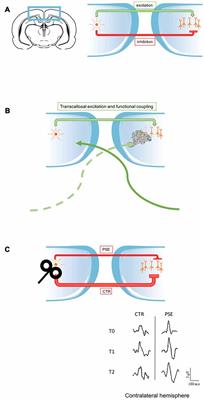 Reorganization of early visual cortex functional connectivity following  selective peripheral and central visual loss